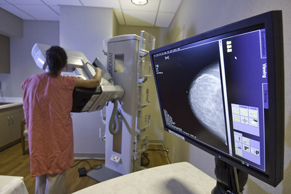 Improving Access to Breast Cancer Screening